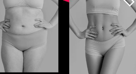 Shrinking Your Belly Fat, Instant stomach reduction.